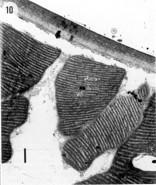 Ultrastruktur eines Chloroplasts von Trichomanes elegans im TEM. Aus Graham, Lee und Norstog (1993, verändert). Querschnitt eines Blattes, mit an der adaxialen Wand angehefteten Chloroplasten. Im Chloroplasten sind eng gestapelte Thylakoidmembranen zu sehen.