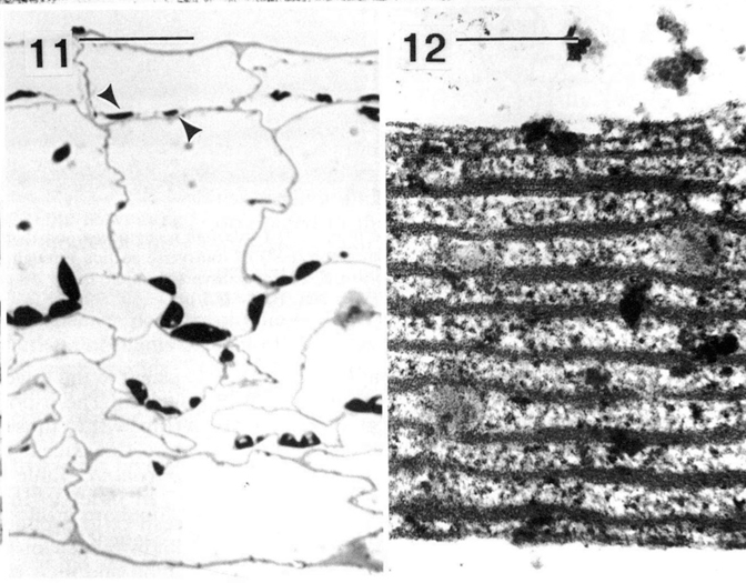 Anatomie und Ultrastruktur der blau schillernden Blätter von Begonia pavonina. Aus Gould und Lee, (1996), verändert. (11) Lichtmikroskopische Aufnahmen von Querschnitten, die Iridoplasten in der adaxialen Epidermis zeigen (Pfeilspitzen). Balken = 50 µm. (12) Elektronenmikroskopische Aufnahmen von Schnitten durch Iridoplasten, die Thylakoide zeigen. Balken = 0,5 µm